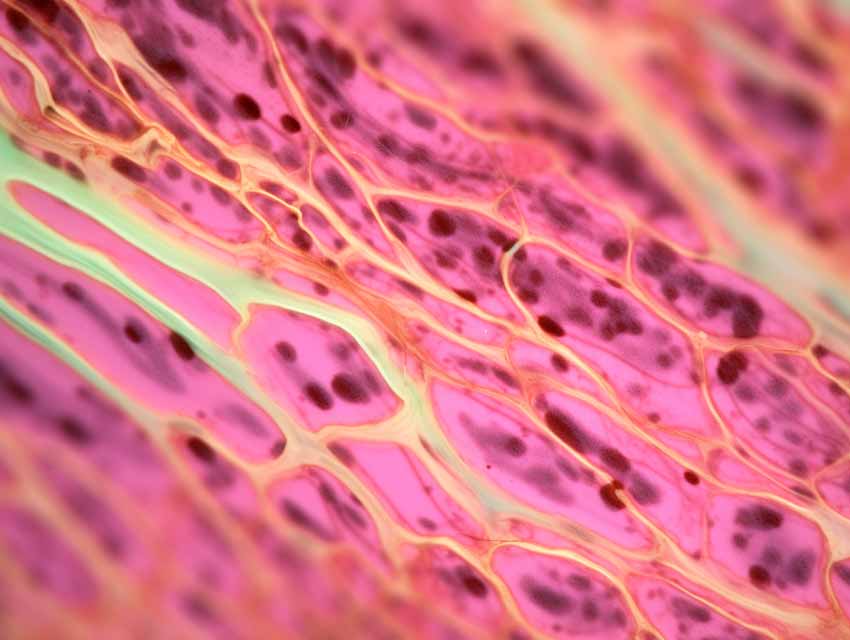 Tiefengewebsmassage hilft bei Orangenhaut und Cellulite. Schlackenstoffe können abtransportiert werden. Darstellung von Gewebe.
